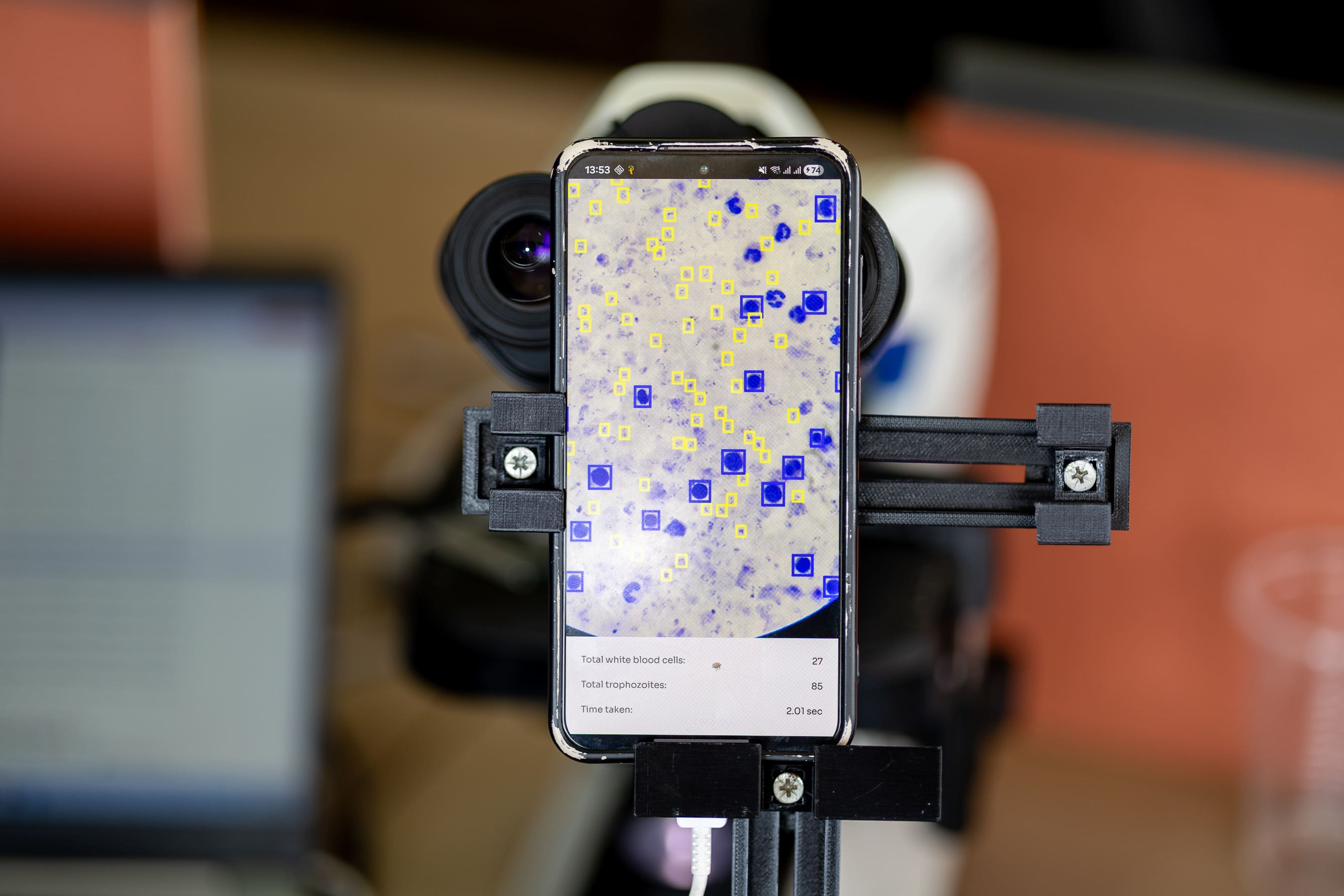 Laboratory professional using microscopy workflow
